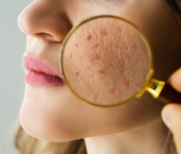 Dermatology